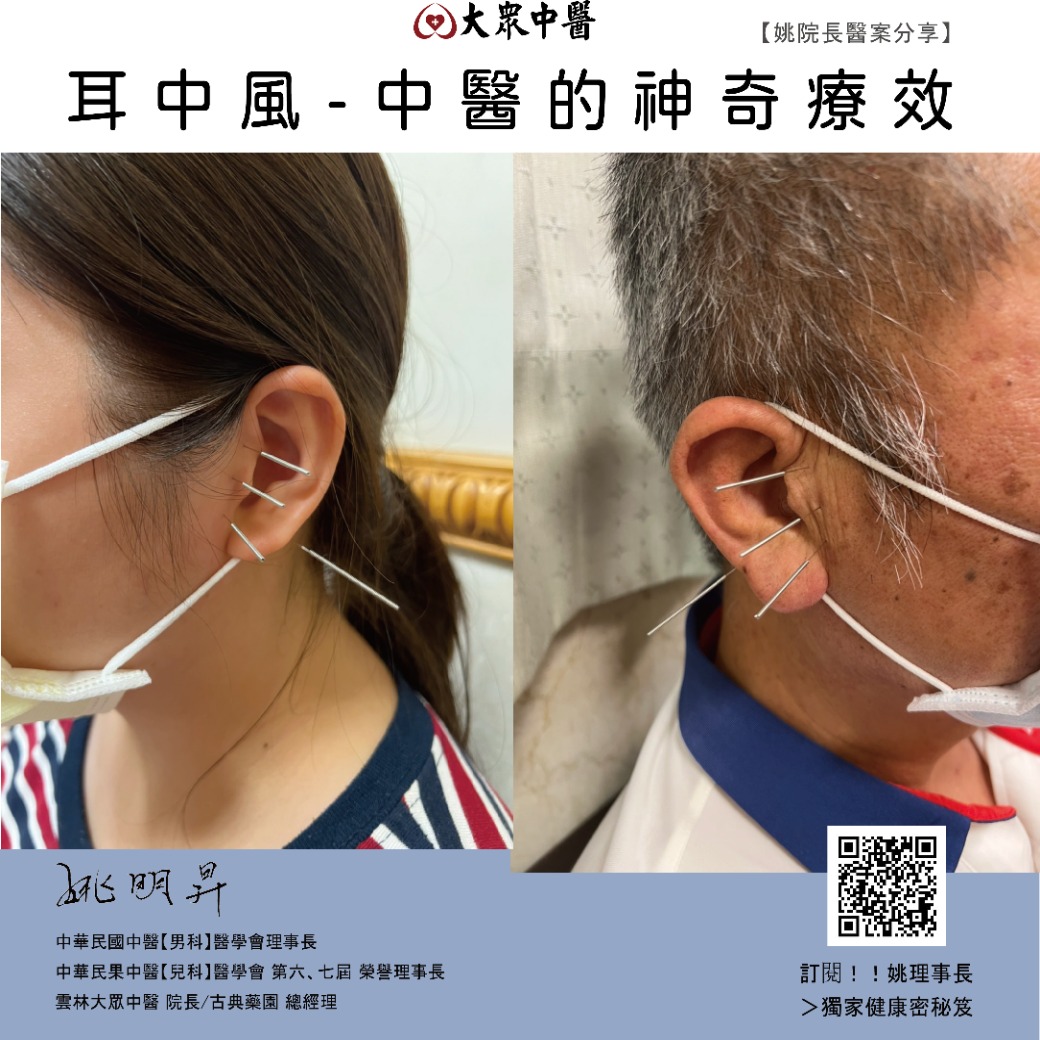 耳中風-中醫的神奇療效