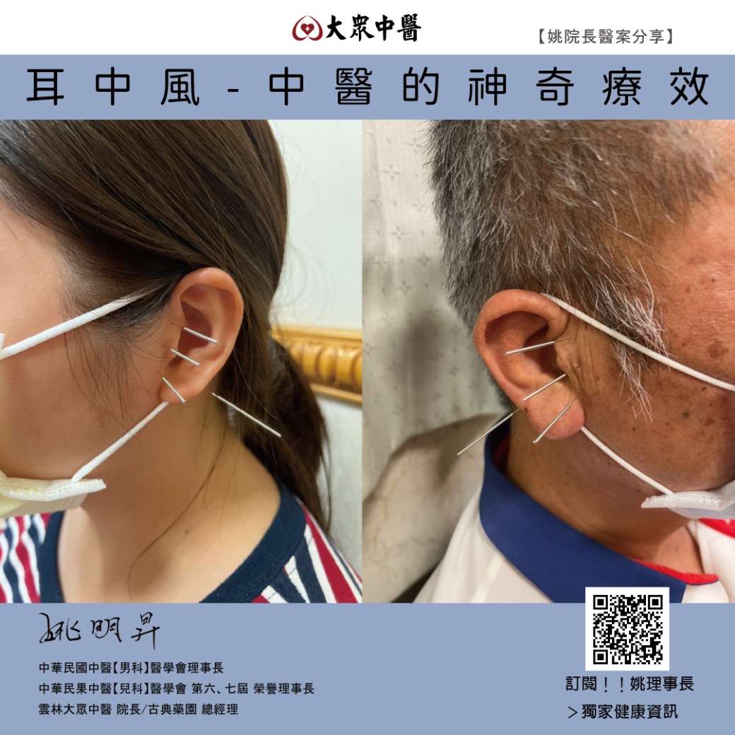 耳中風-中醫的神奇療效