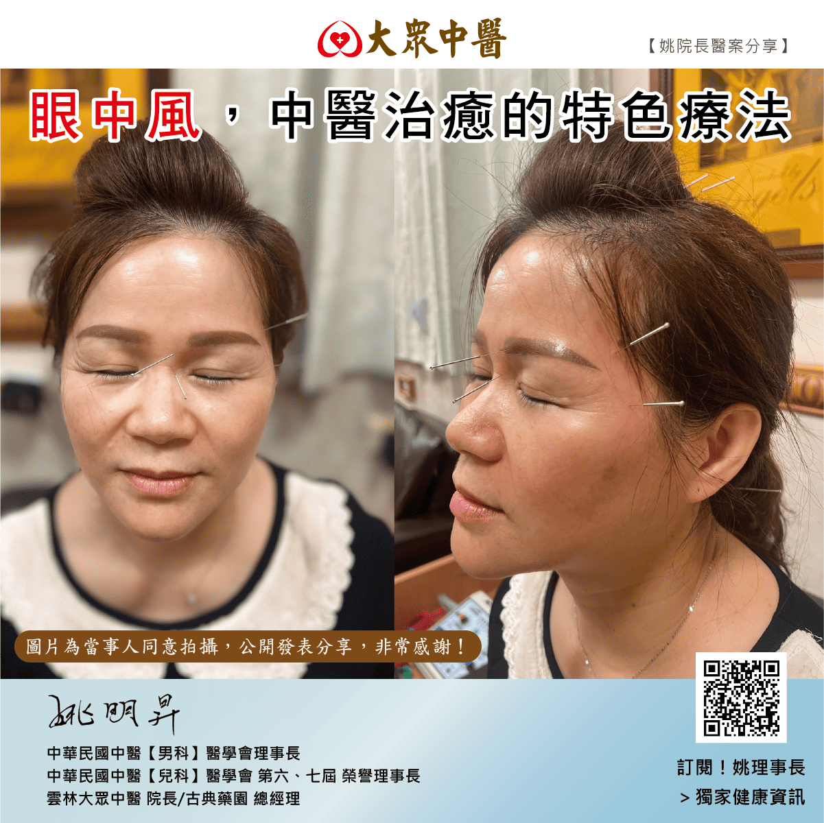 眼中風，中醫治癒的特色療法
